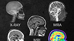 В чем разница разных методов сканирования головы?